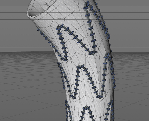 aortic stent model