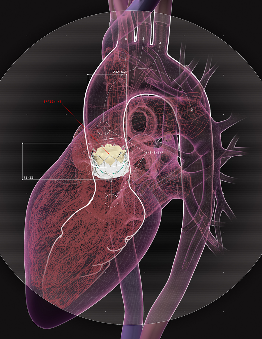 technical illustration heart valve