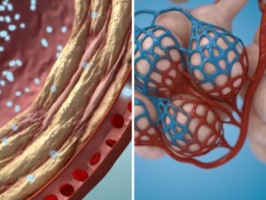 alveoli IPF illustration