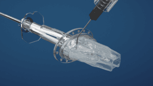 lens injector animation featured