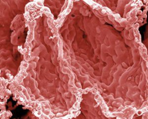 alveoli photo reference