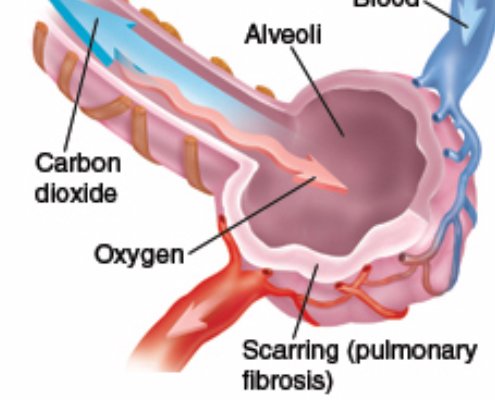 alveoli anatomy reference